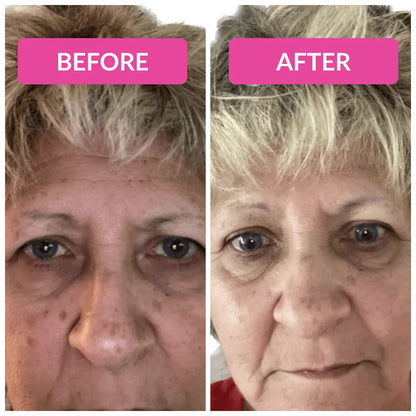 Super C Serum